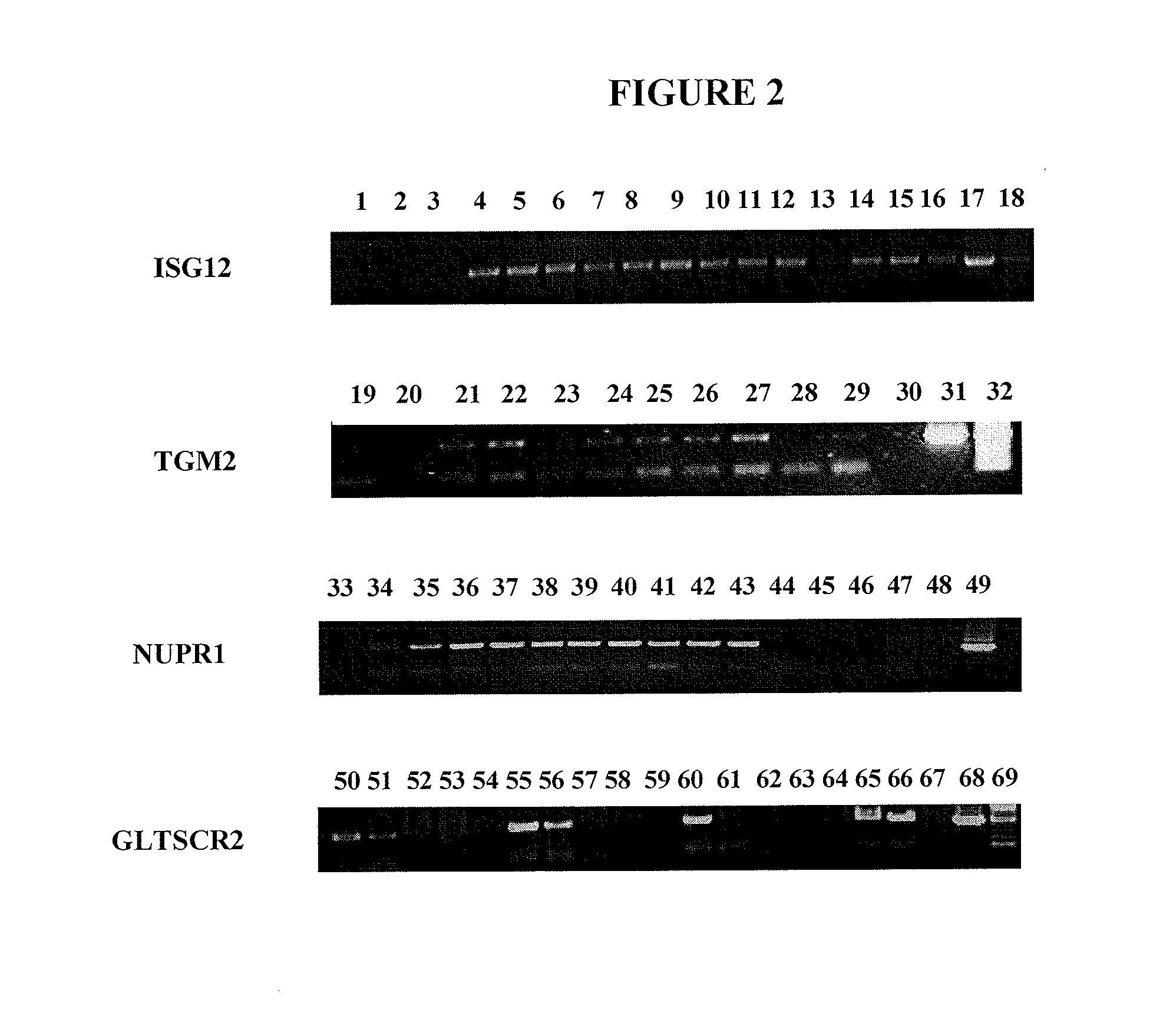 Rapid method for generating gene knock down model