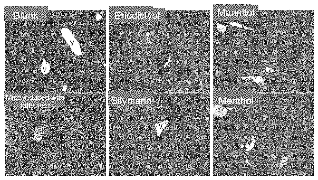 Methods and compositions for preventing or treating fatty liver, protecting liver function or ameliorating liver diseases caused by fatty liver or other associated disorders