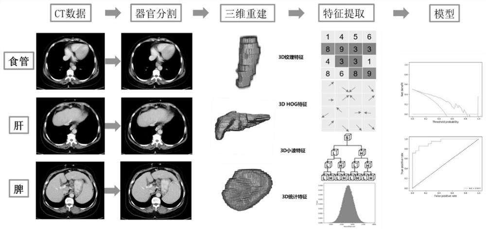 Enhanced CT (Computed Tomography) imageomics feature processing method for upper abdomen of liver cirrhosis patient and application thereof