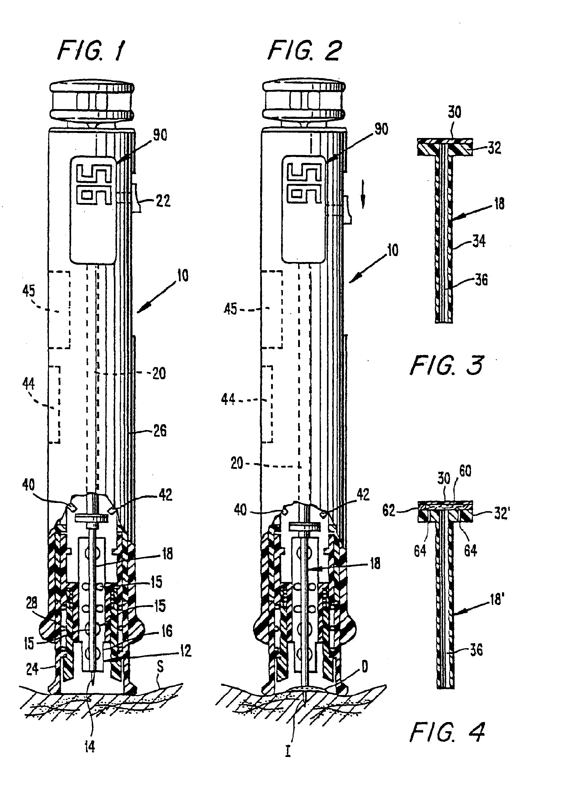 Methods and apparatus for sampling and analyzing body fluid