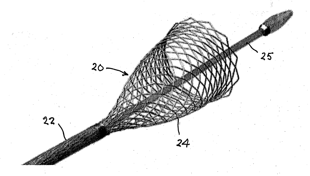 Endovascular occlusive device and associated surgical methodology