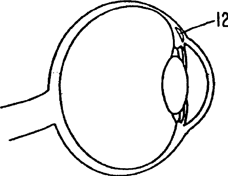 Ocular analyte sensor
