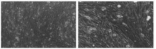 A method for constructing immortalized porcine hepatic stellate cell line, immortalized porcine hepatic stellate cell line and application