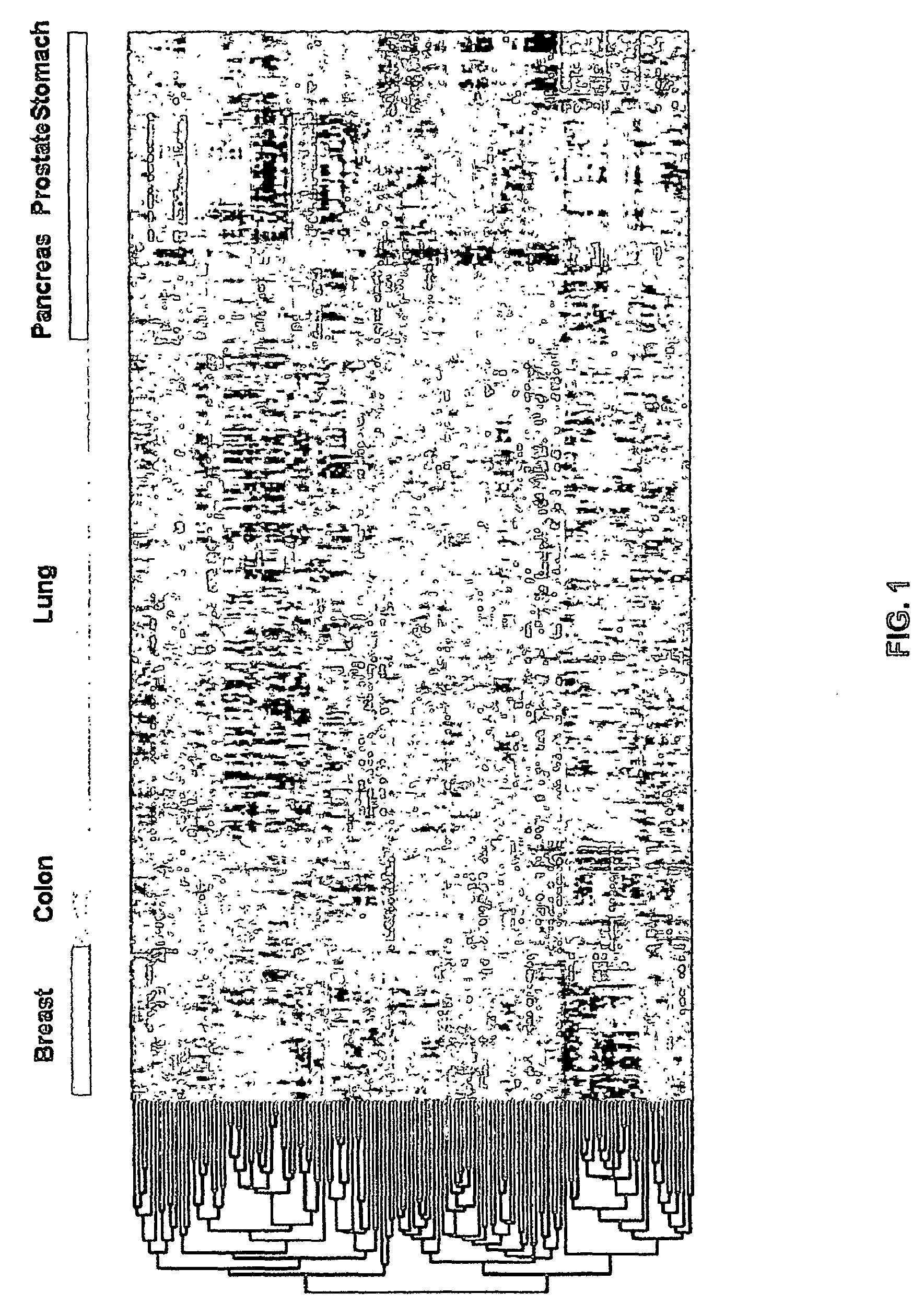 MicroRna-Based Methods and Compositions for the Diagnosis, Prognosis and Treatment of Solid Cancers