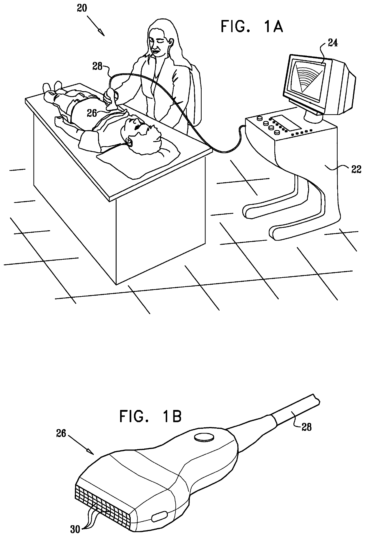 Clutter suppression in ultrasonic imaging systems