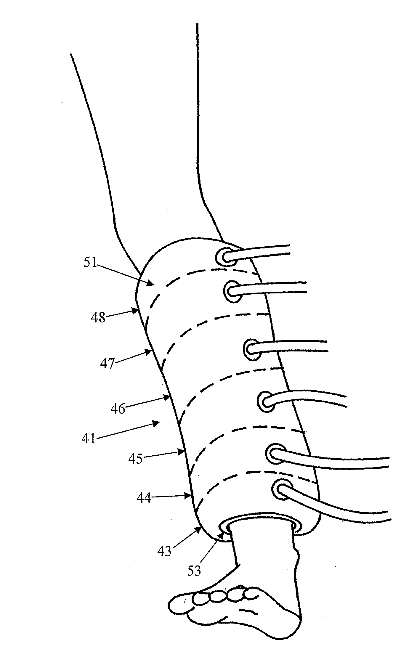 Apparatus for Preventing Deep Vein Thrombosis