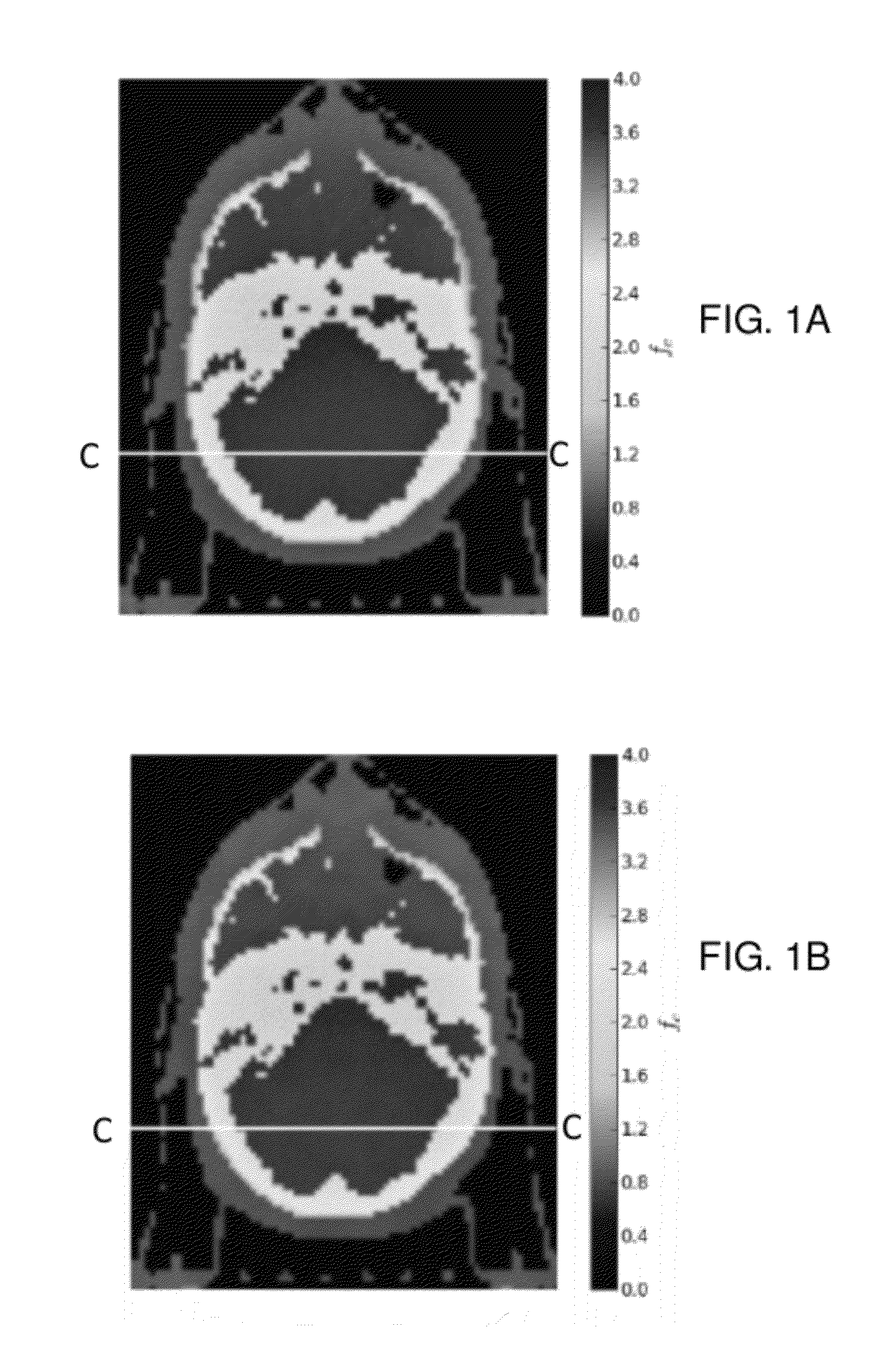 System and method for estimating radiation dose and distribution using medium-dependent-correction based algorithms (MDC)
