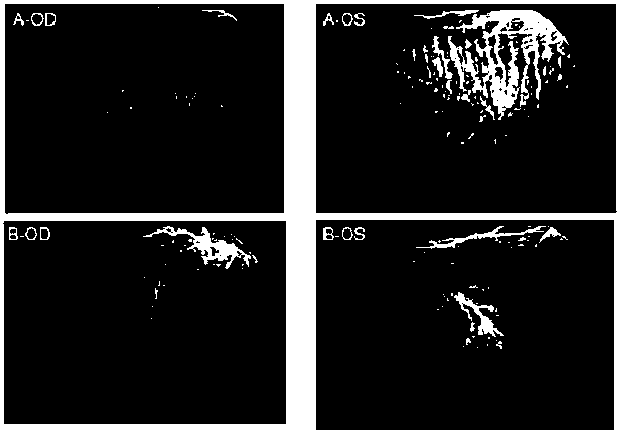 Application of FITC-dextran in manufacturing fundus angiographic agent