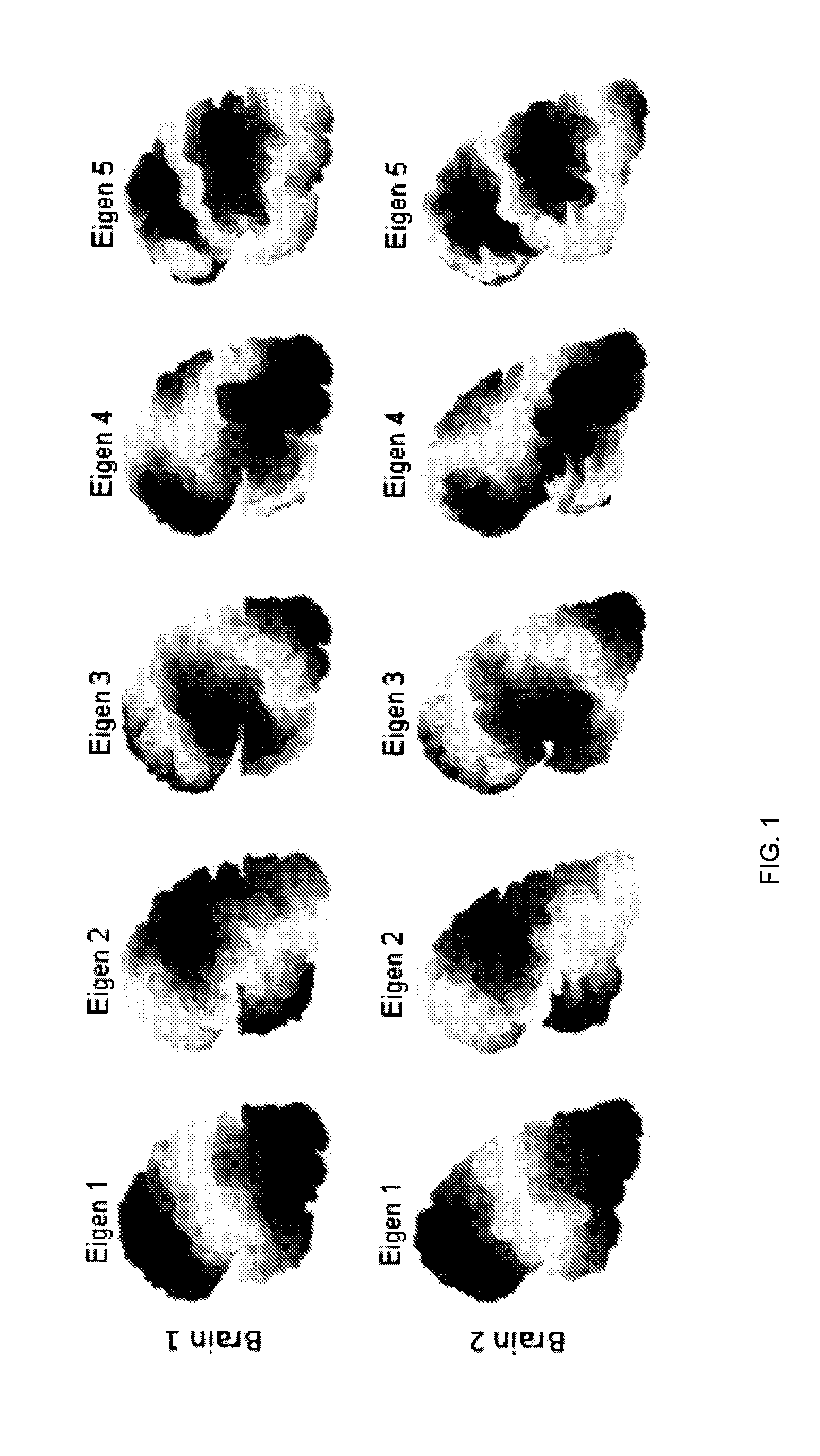 Methods and systems for fast automatic brain matching via spectral correspondence