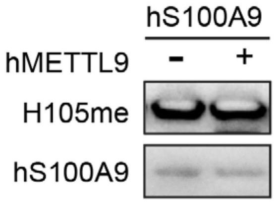 Specific histidine methylation modified S100A9 protein immunogen, polyclonal antibody and preparation method of polyclonal antibody