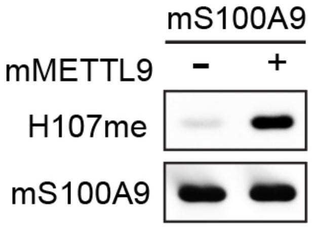 Specific histidine methylation modified S100A9 protein immunogen, polyclonal antibody and preparation method of polyclonal antibody