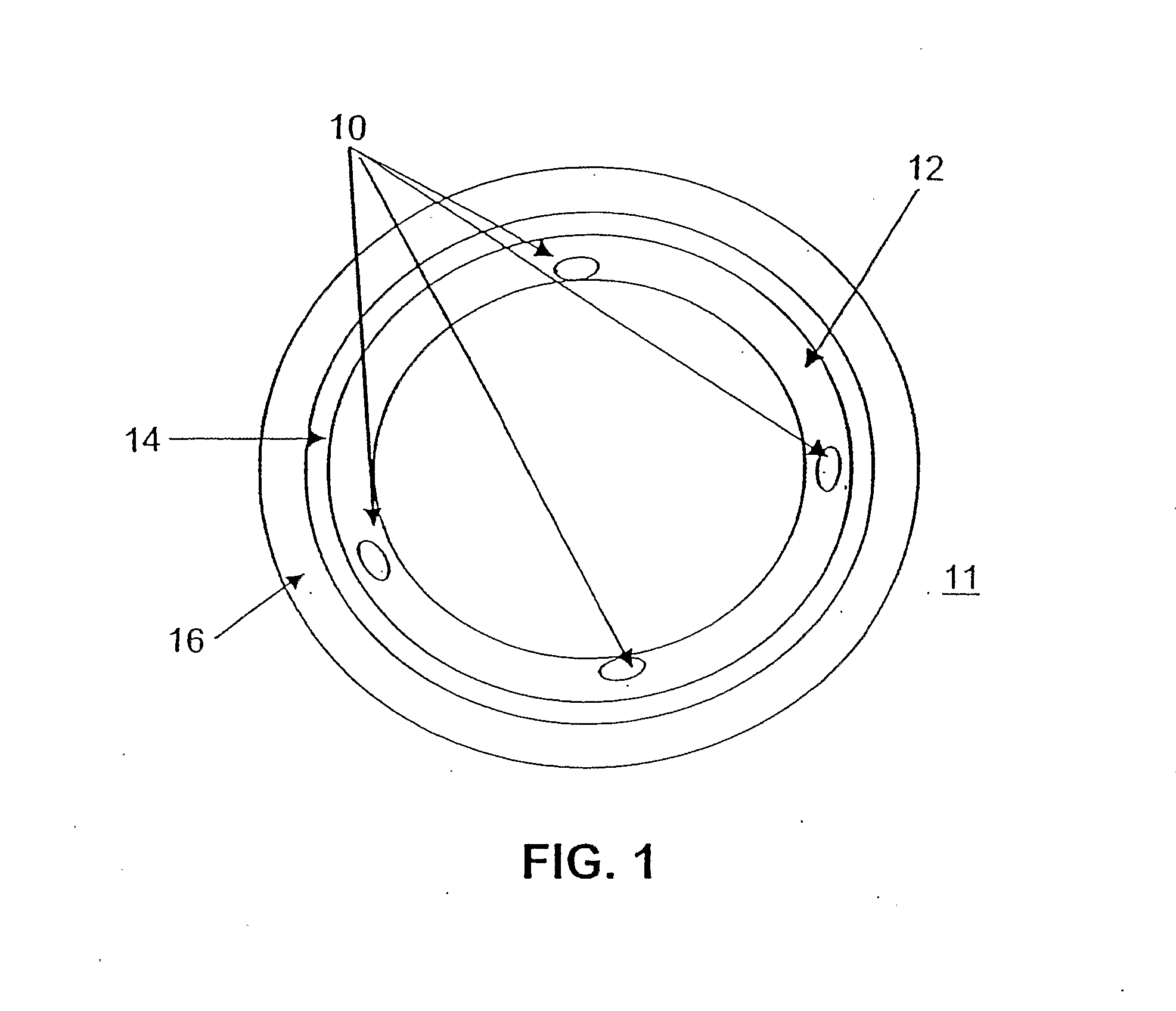 Bioactive Stents For Type II Diabetics and Methods for Use Thereof