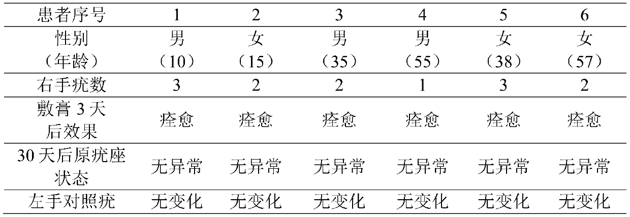 Single traditional Chinese medicine external application ointment for removing wart and preparation method thereof