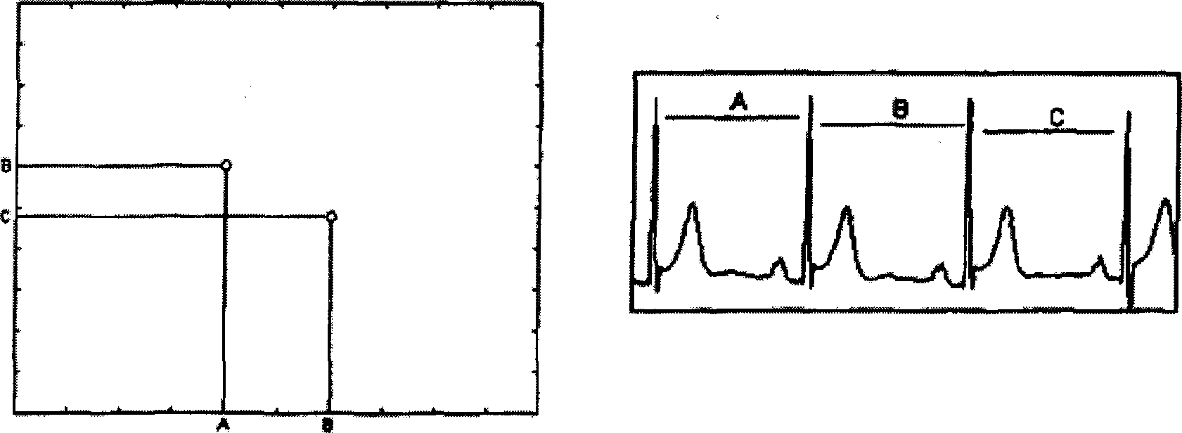 Dynamic characteristic analysis method of real-time tendency of heart state