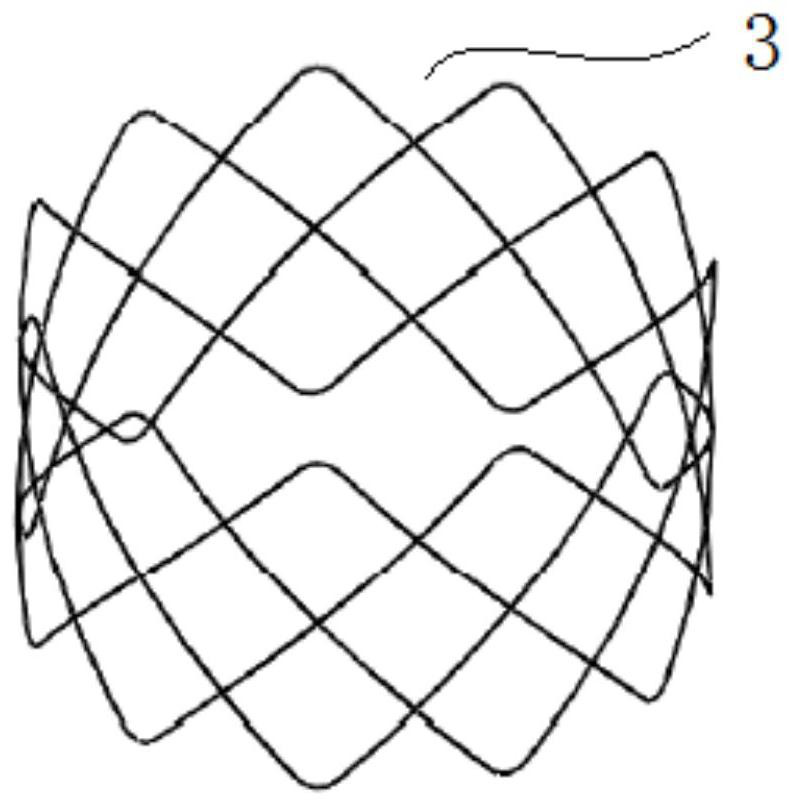 sinus stent