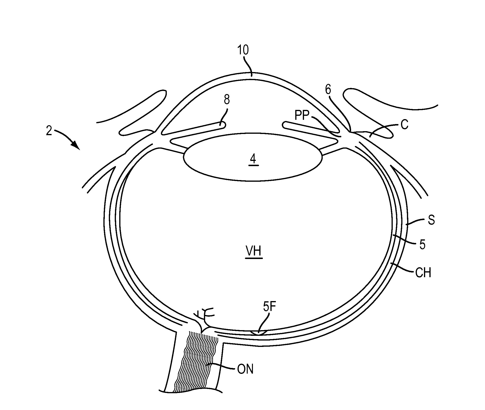 Eye Covering and Refractive Correction Methods and Apparatus Having Improved Tear Flow, Comfort, and/or Applicability
