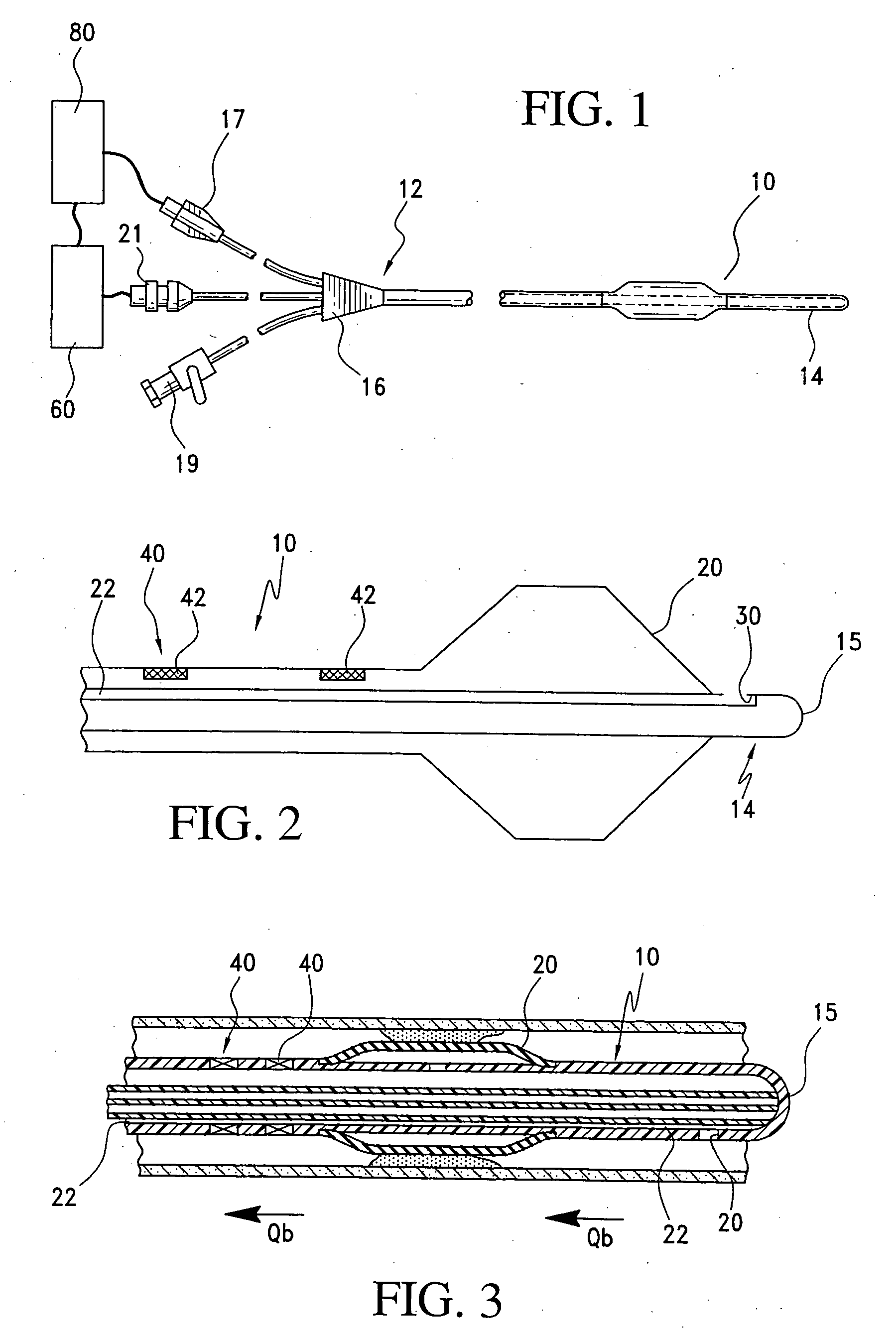 Method and apparatus for determining a blood flow during a vascular access dysfunction corrective procedure