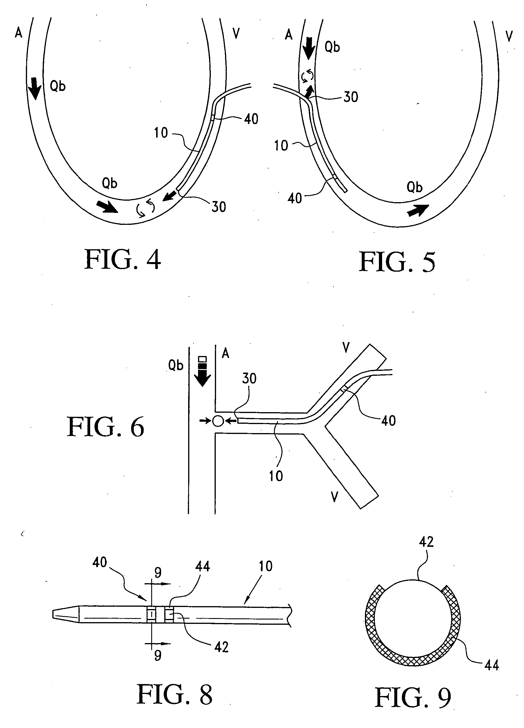 Method and apparatus for determining a blood flow during a vascular access dysfunction corrective procedure