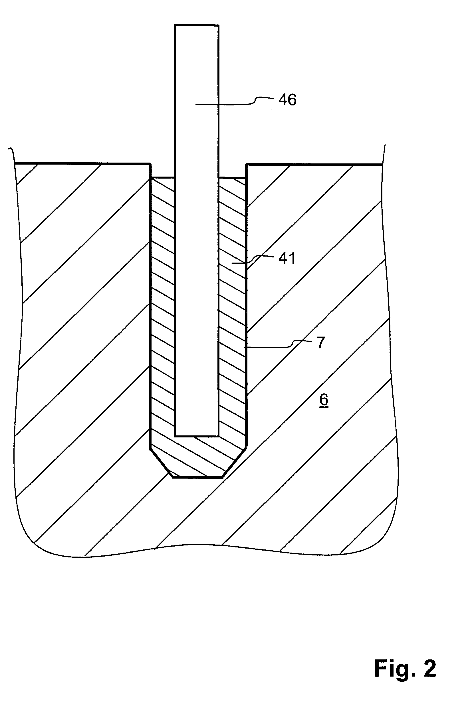 Method of anchoring fastening element