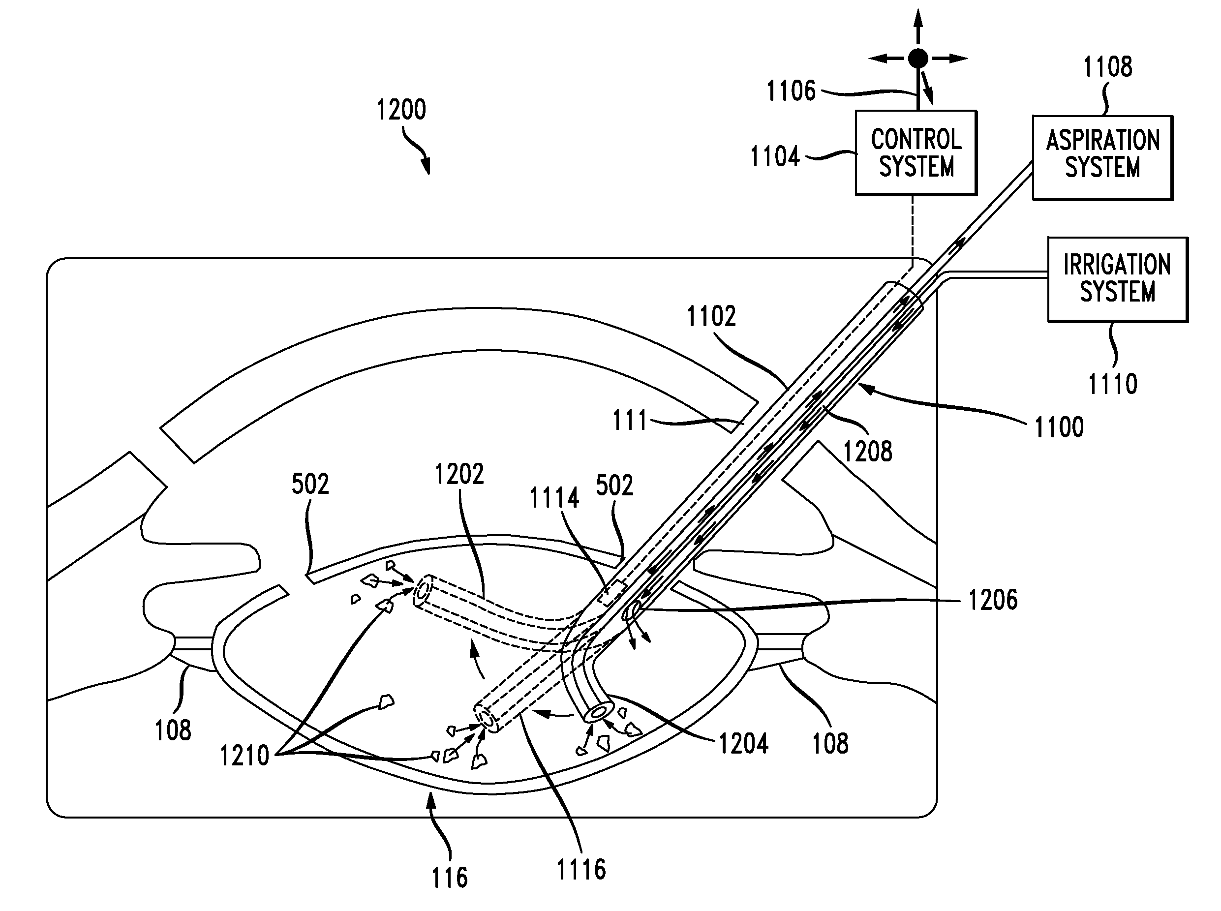 System and method of performing femtosecond laser accomodative capsulotomy