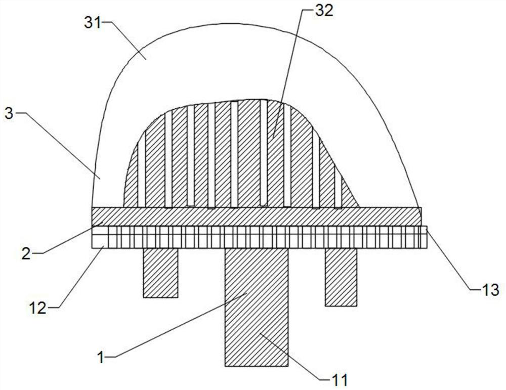 Porous metal and PEEK composite implanted joint prosthesis and preparation method