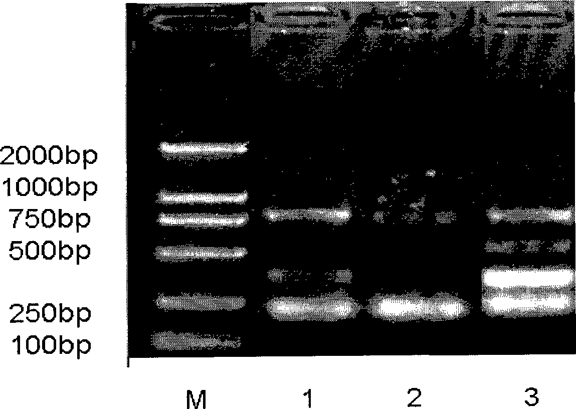 Multiple PCR fast detecting method for oral cavity pathogen