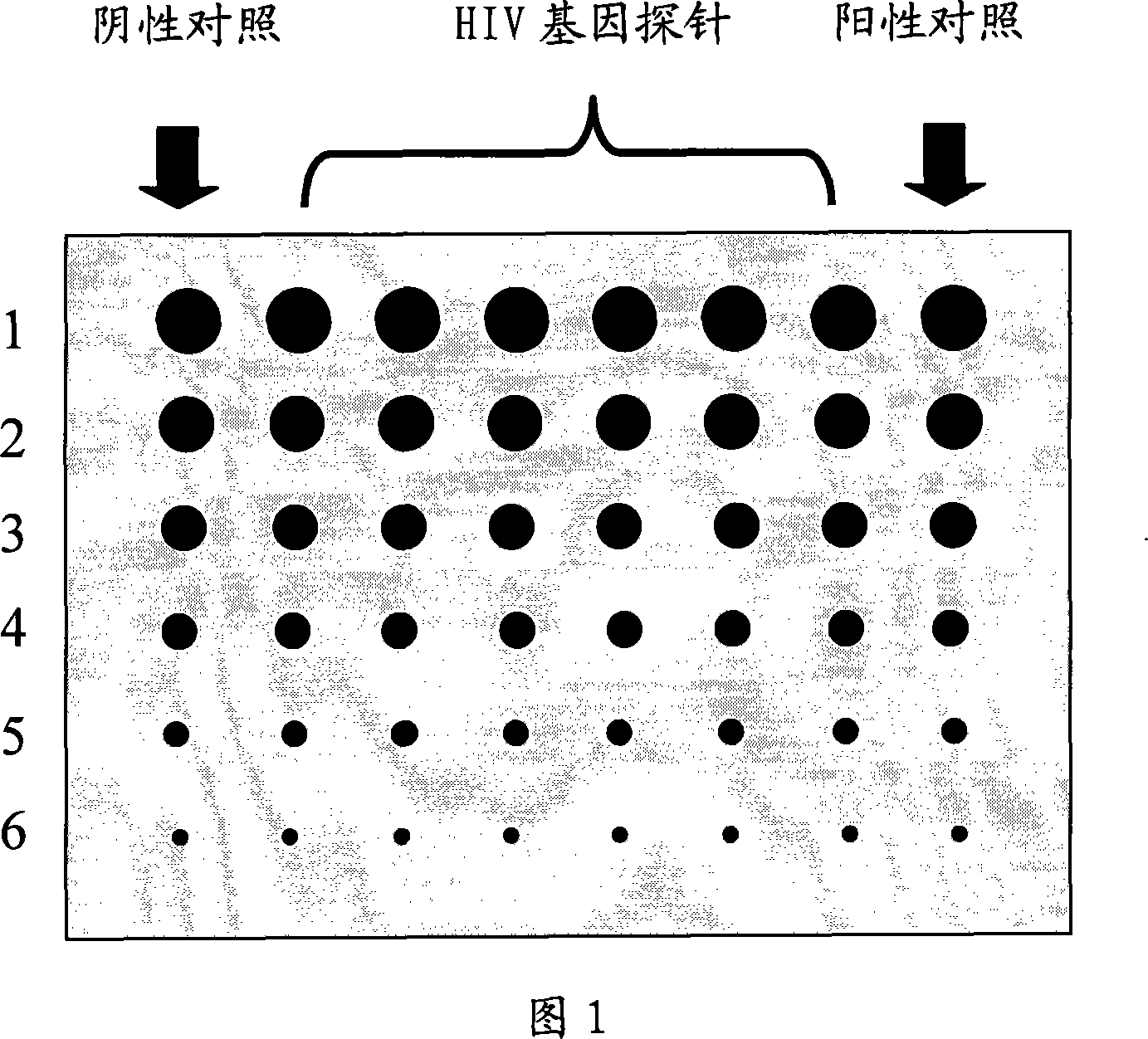 HIV gene detecting chip and its prepn process and usage detecting HIV nucleic acid