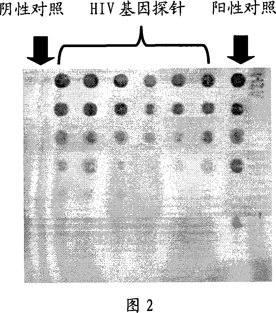 HIV gene detecting chip and its prepn process and usage detecting HIV nucleic acid