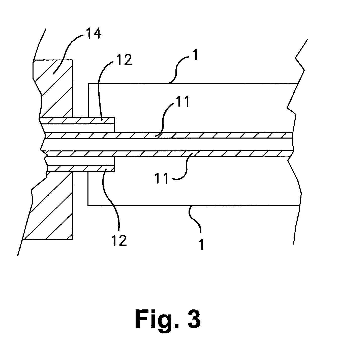 Sputtering target with bonding layer of varying thickness under target material
