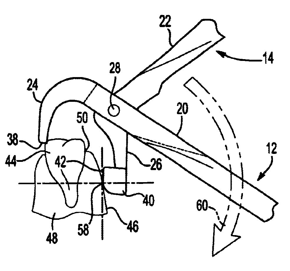 Dental plier design with offsetting jaw and pad elements for assisting in removing upper and lower teeth utilizing the dental plier design