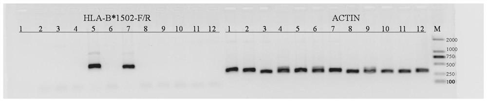 Primers And Method For Detecting HLA-B*1502 Typing Capable Of Being ...