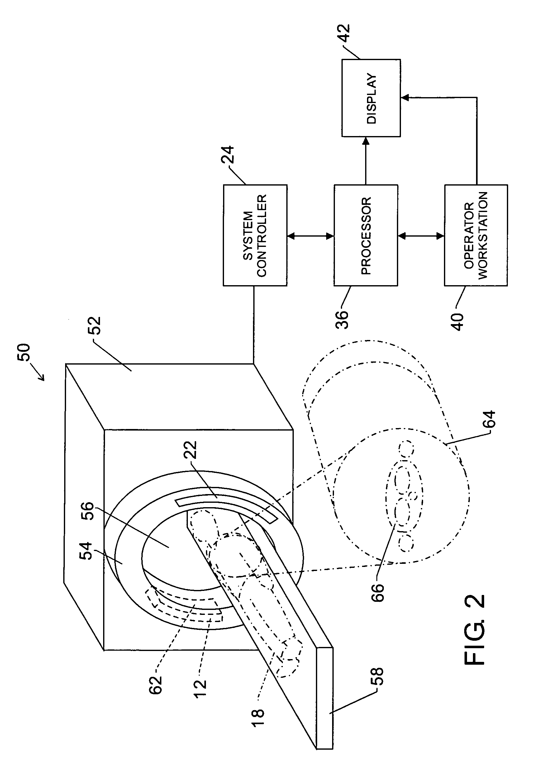Method and apparatus for reduction of artifacts in computed tomography images