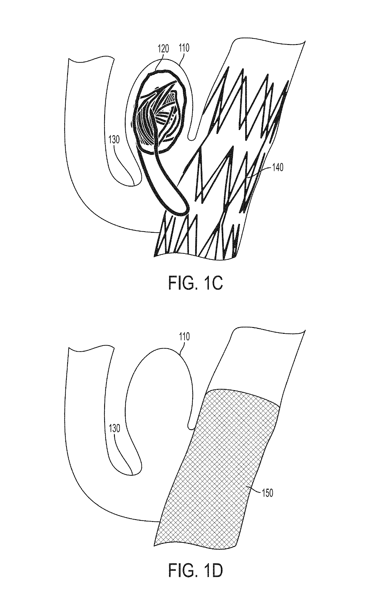 Geometry based method for simulating fluid flow through heterogeneous porous media