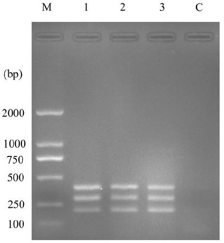Method for detecting three potato pathogenic bacteria by multiple PCR (polymerase chain reaction) techniques