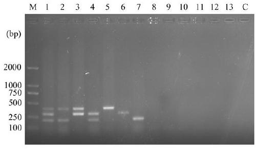 Method for detecting three potato pathogenic bacteria by multiple PCR (polymerase chain reaction) techniques