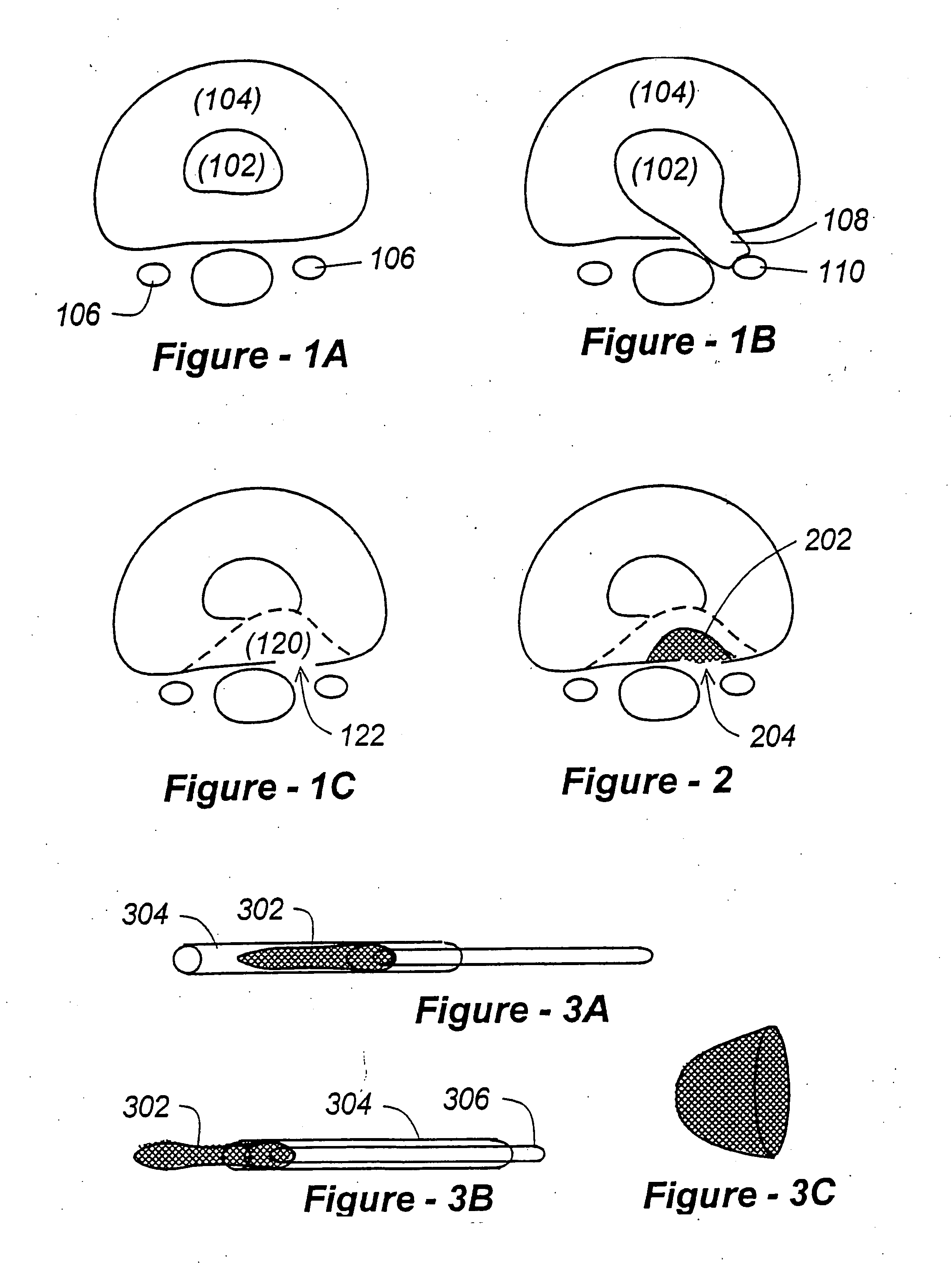 Methods for treating a defect in the annulus fibrosis