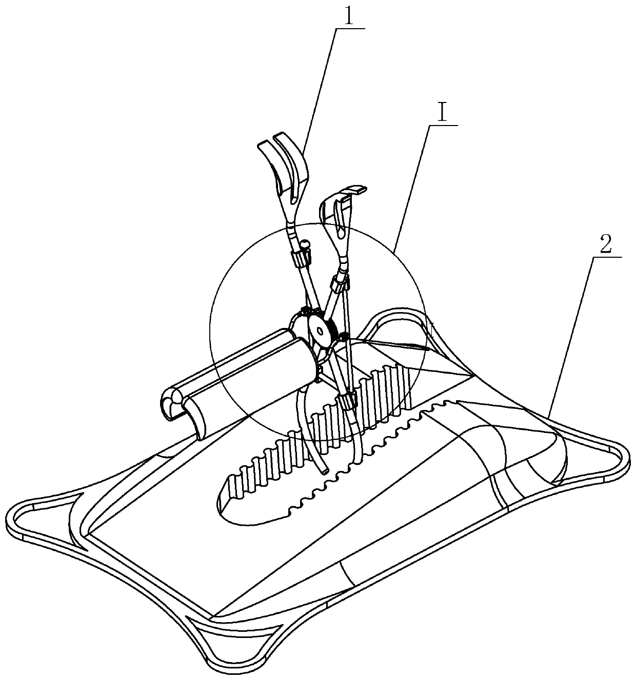 Supporting device for umbilical cord prolapse