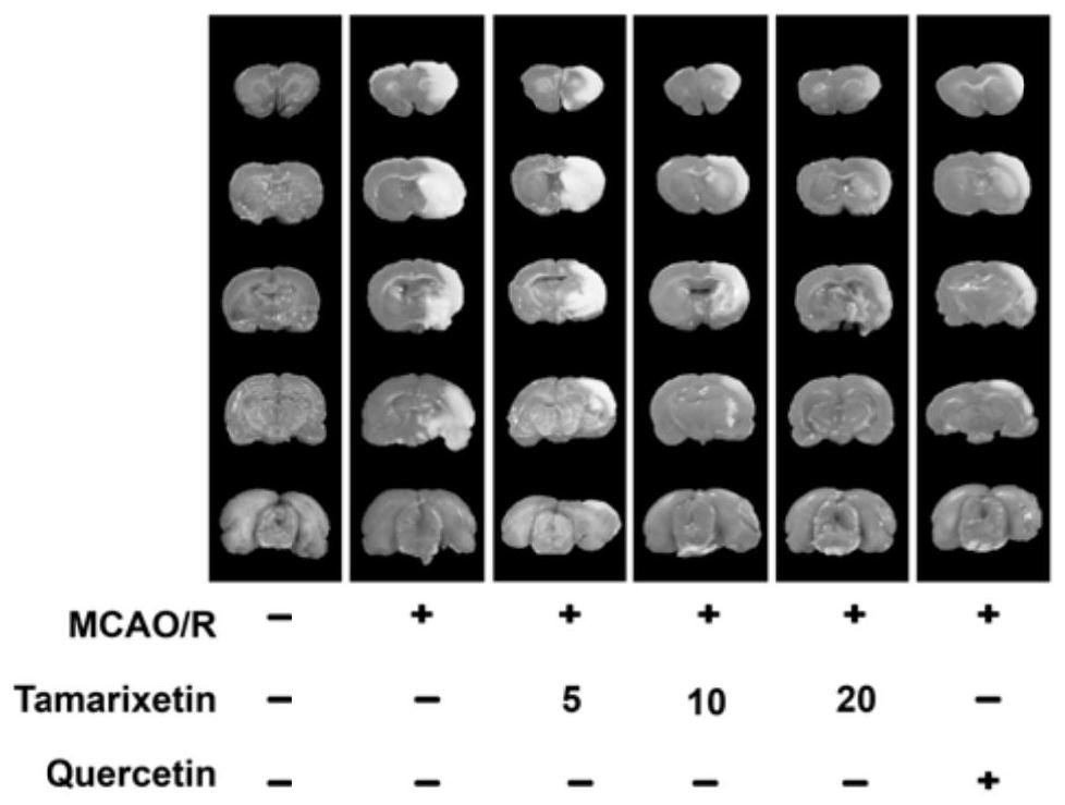 Application of tamaristin in preparation of medicine for preventing or treating ischemic encephalopathy