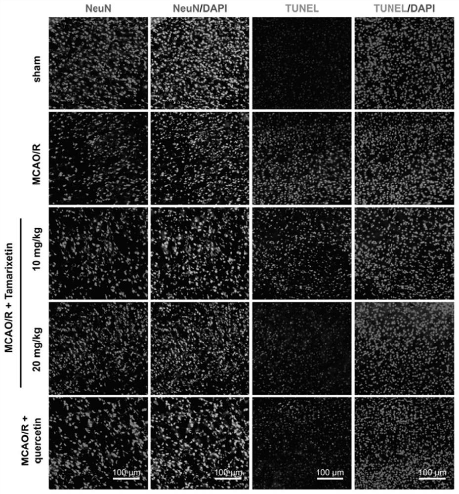 Application of tamaristin in preparation of medicine for preventing or treating ischemic encephalopathy