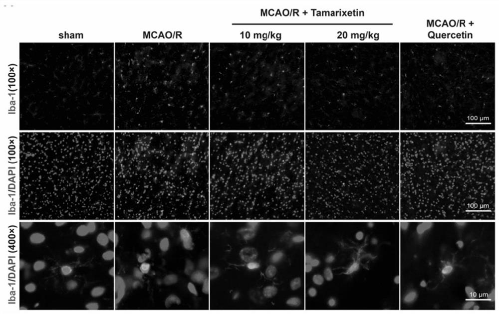 Application of tamaristin in preparation of medicine for preventing or treating ischemic encephalopathy