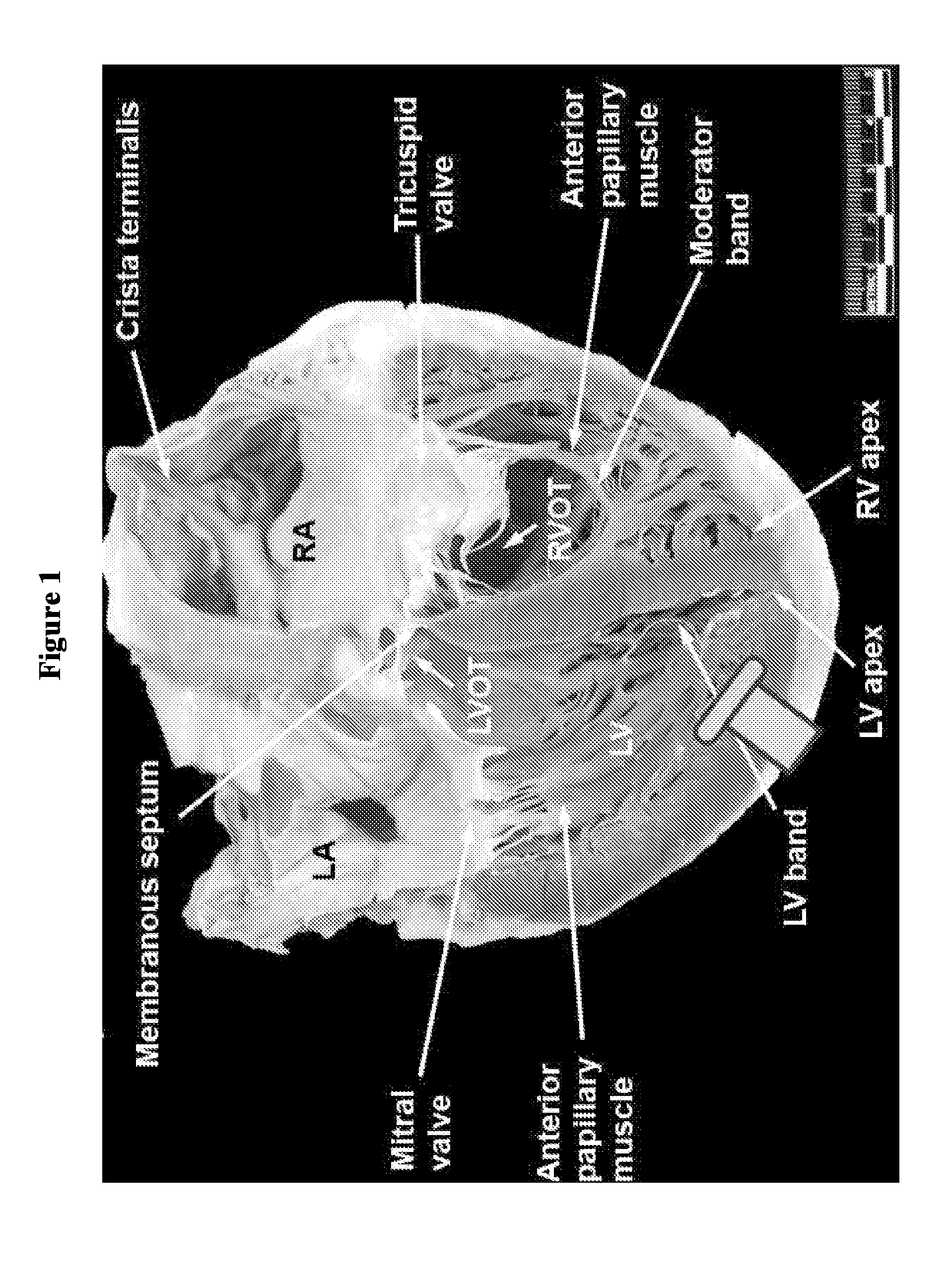 Closure device and methods and systems for using same
