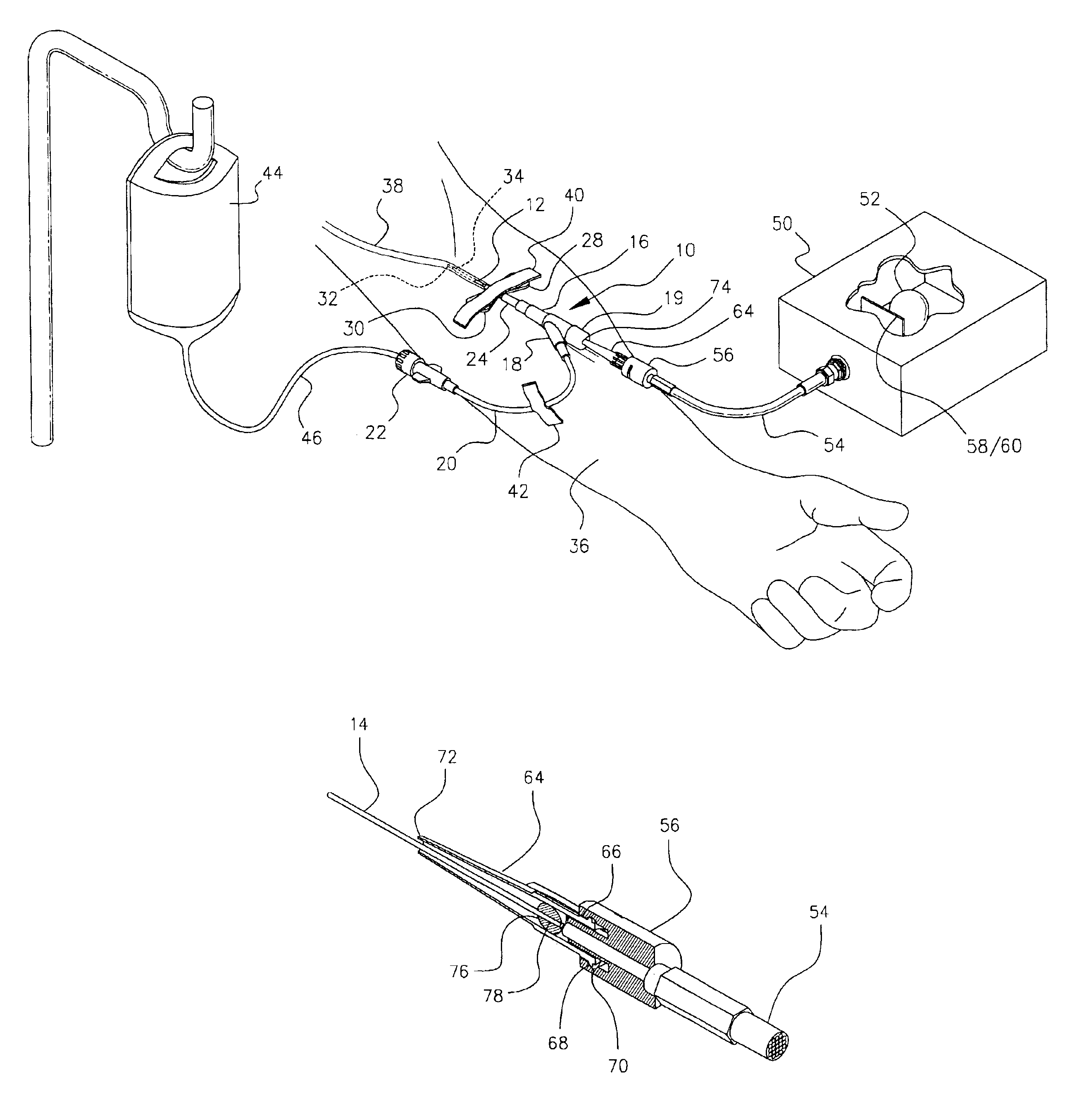 Apparatus for conveying a light source to an intravenous needle to kill blood pathogens
