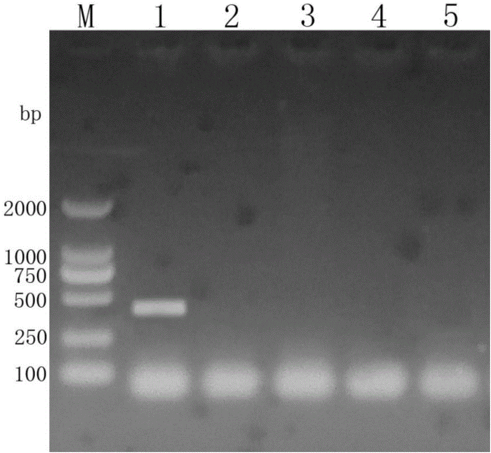 Eriocheir sinensis white spot syndrome virus specificity PCR detection kit and method