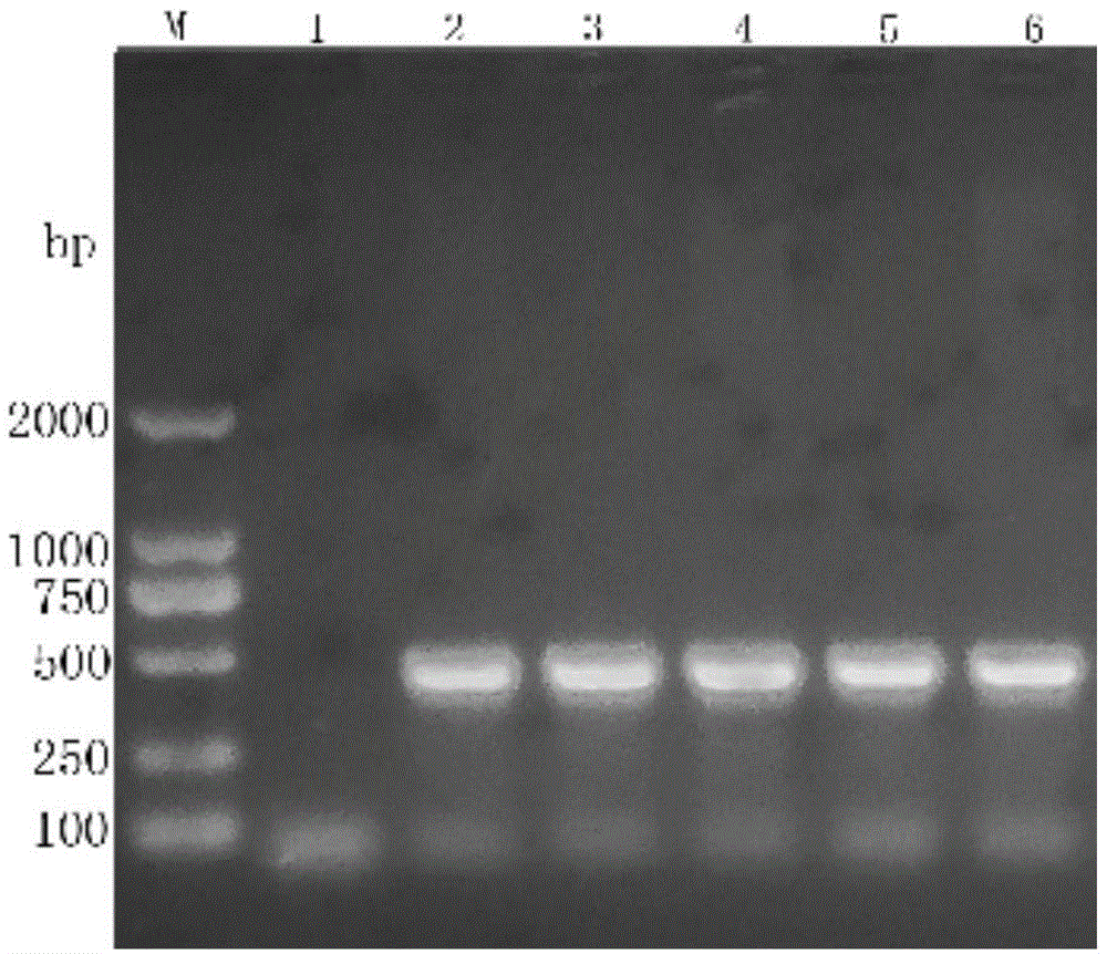 Eriocheir sinensis white spot syndrome virus specificity PCR detection kit and method