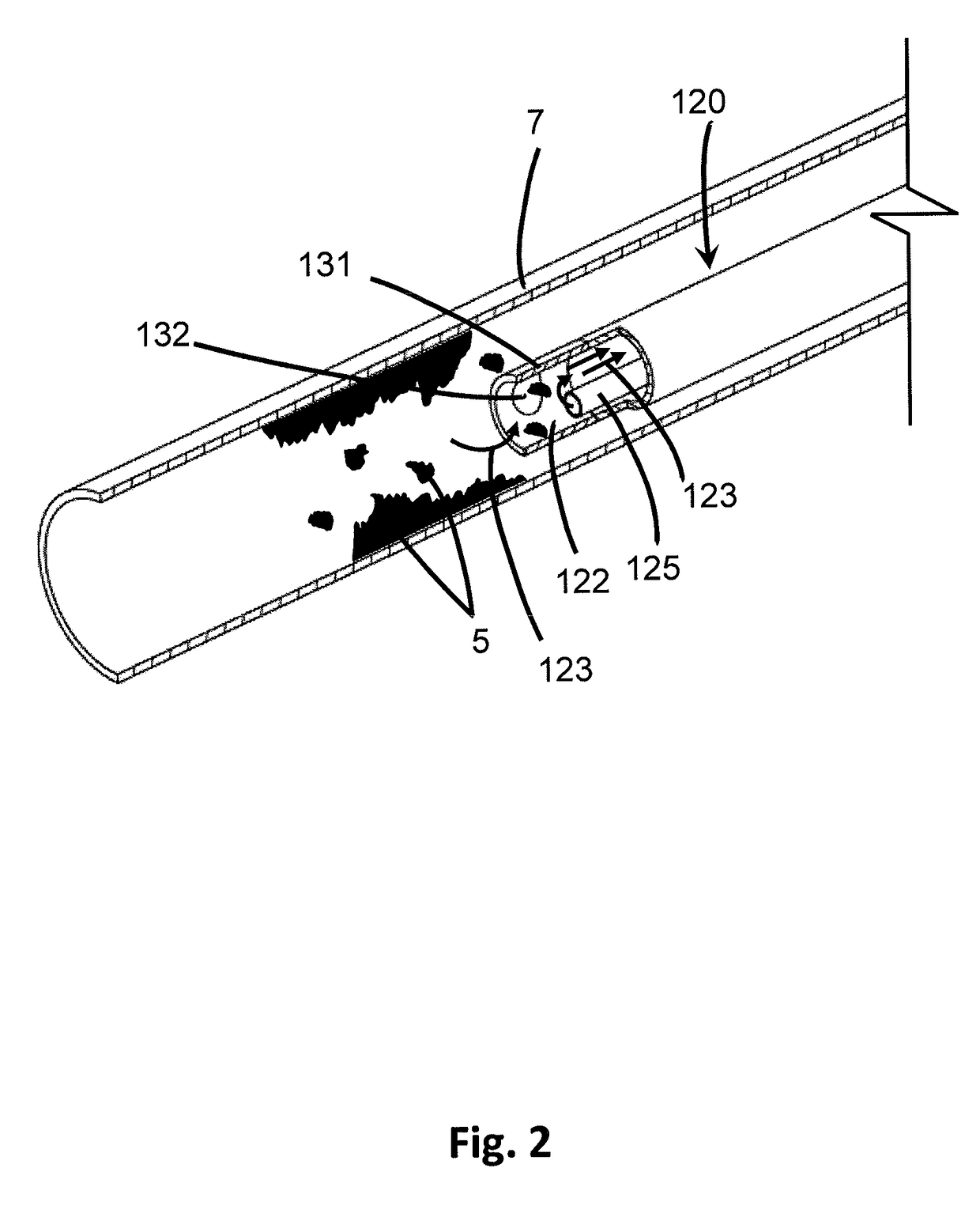 Device for In Situ Clearing of Occlusions in Tubing