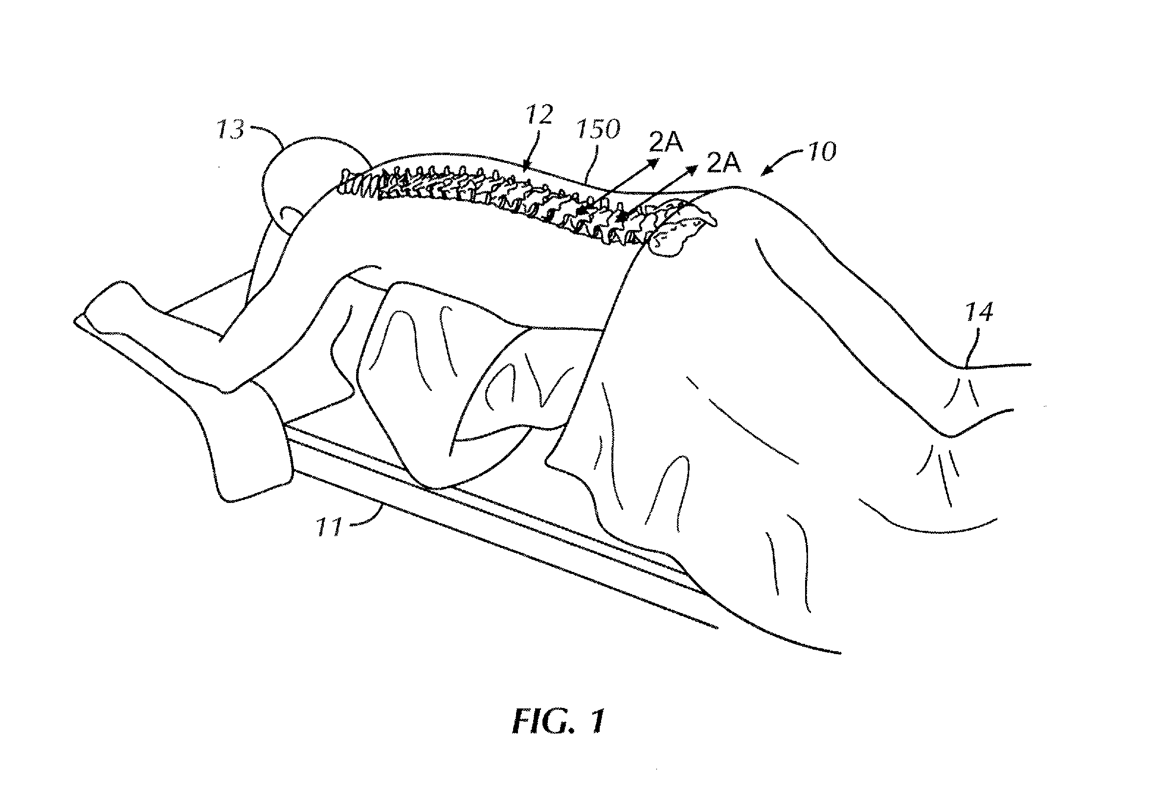 Surgical instrument system and method for providing retraction and vertebral distraction