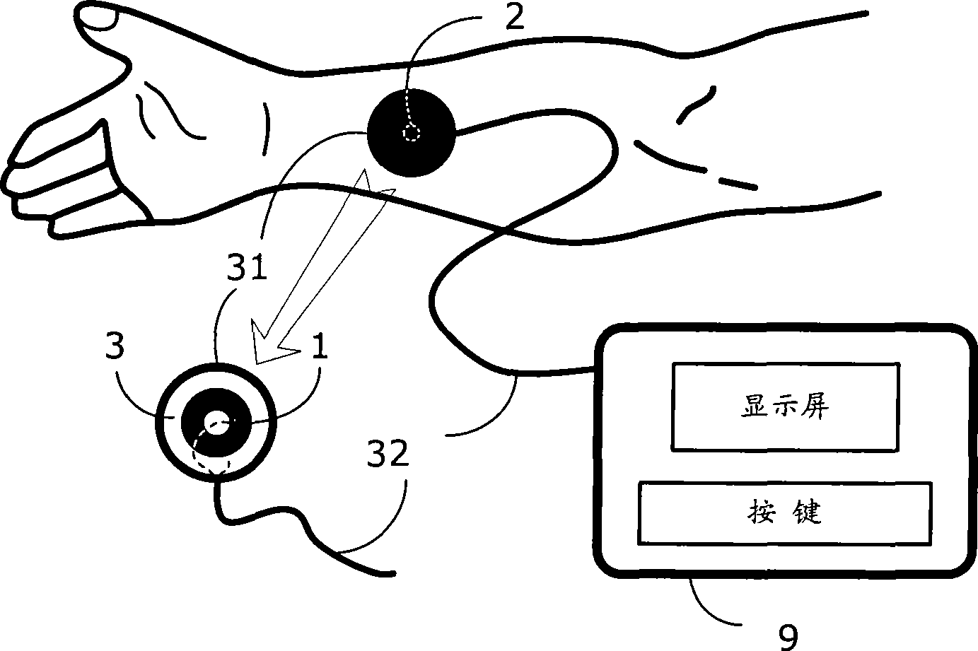 Single acupuncture point electro-acupuncture method and device