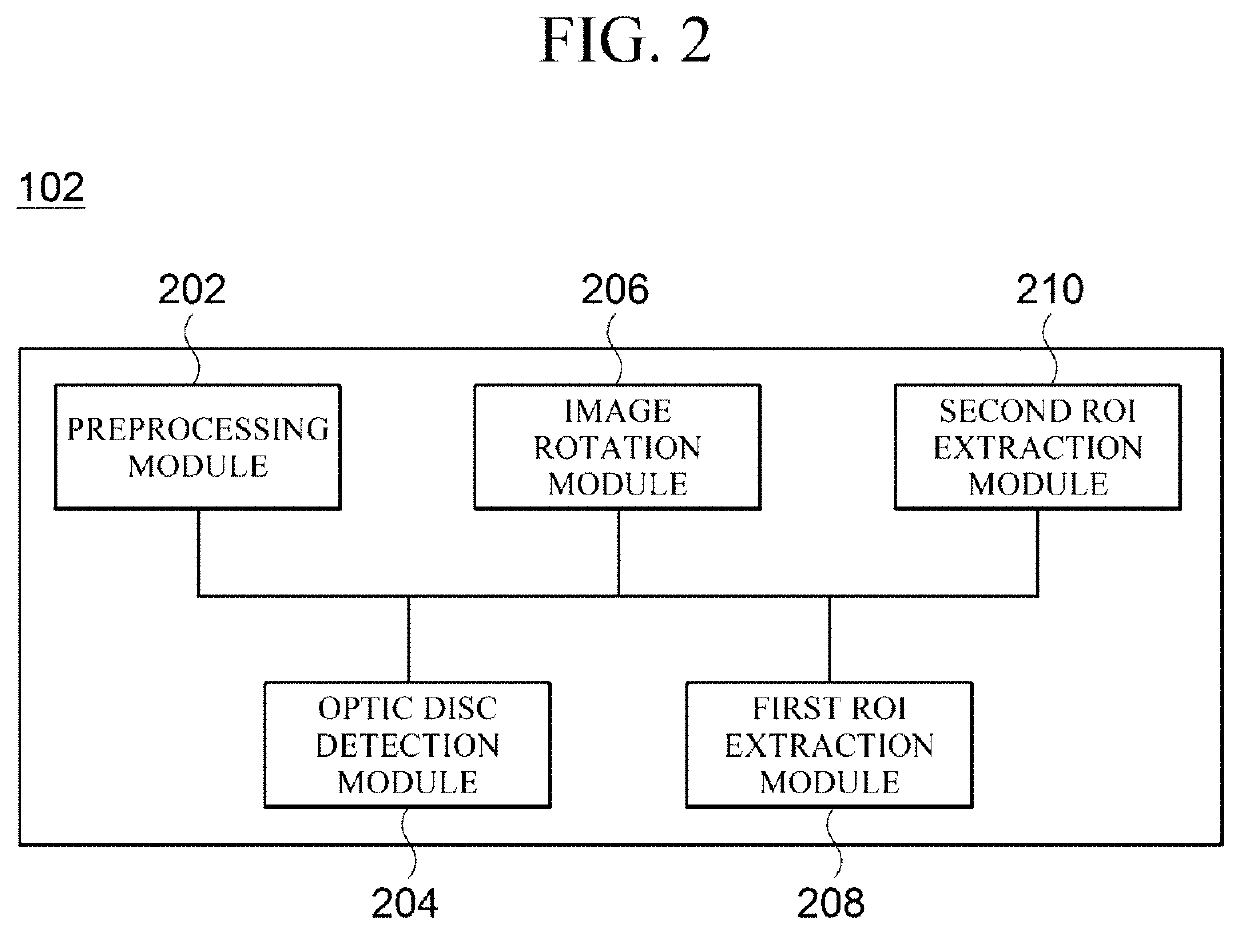 Apparatus for diagnosing glaucoma