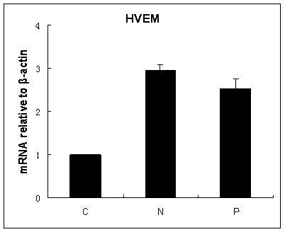 Application of HVEM (herpesvirus entry mediator) gene in preparing product for liver cancer diagnosis and prognosis prediction