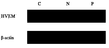 Application of HVEM (herpesvirus entry mediator) gene in preparing product for liver cancer diagnosis and prognosis prediction